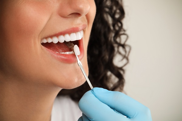 Surprising Benefits Of Dental Veneers You Did Not Know